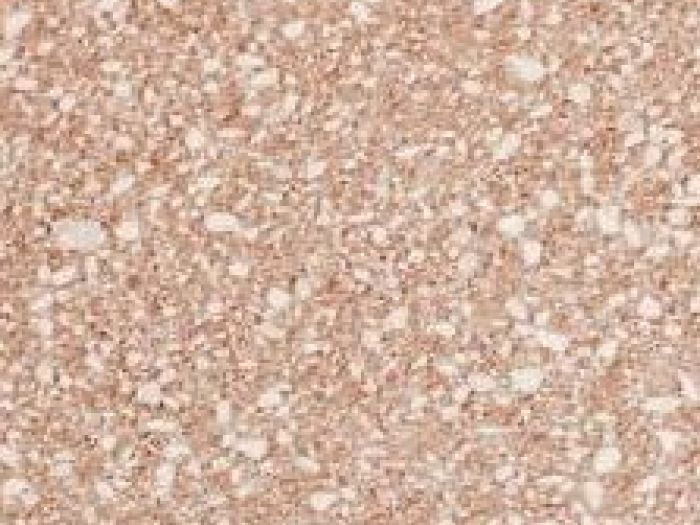 Archisio - Antolini Mce Srl Manufatti Cemento Edilizia - Progetto Recinzioni in cls