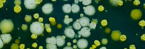 Archisio - Giesse Disinfestazioni - Progetto Disinfezioni